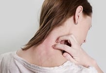 How to Differentiate between Psoriasis and Eczema